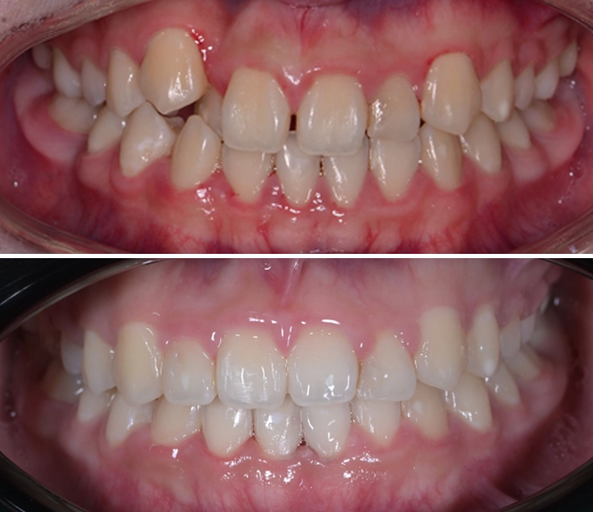 ortho1