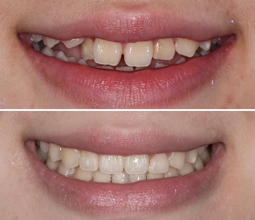 ortho2