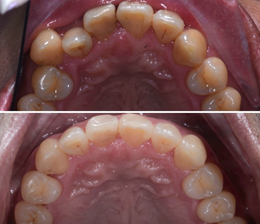 ortho3