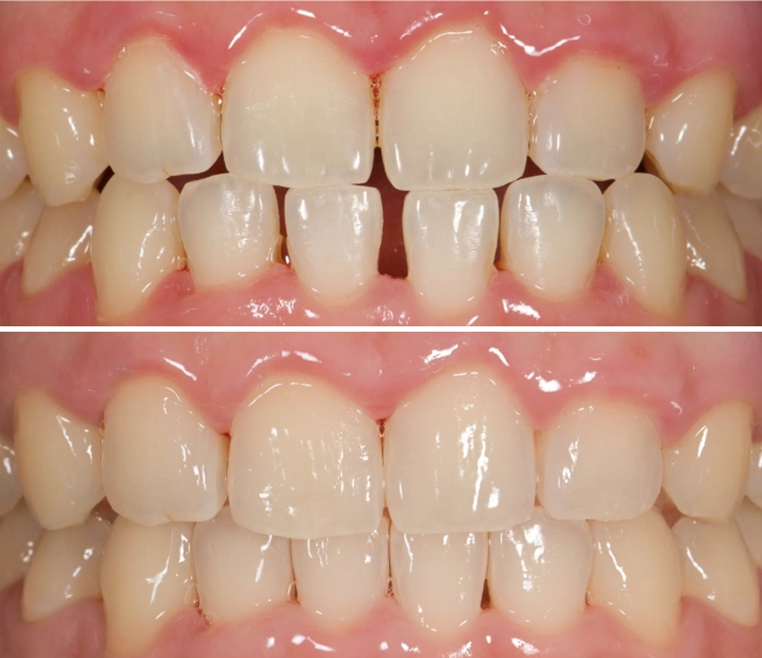 ortho4