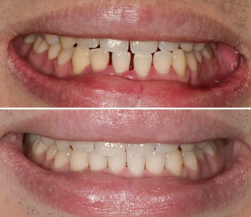 ortho5